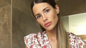 Gala Caldirola recibió duras críticas por supuestos retoques en su rostro