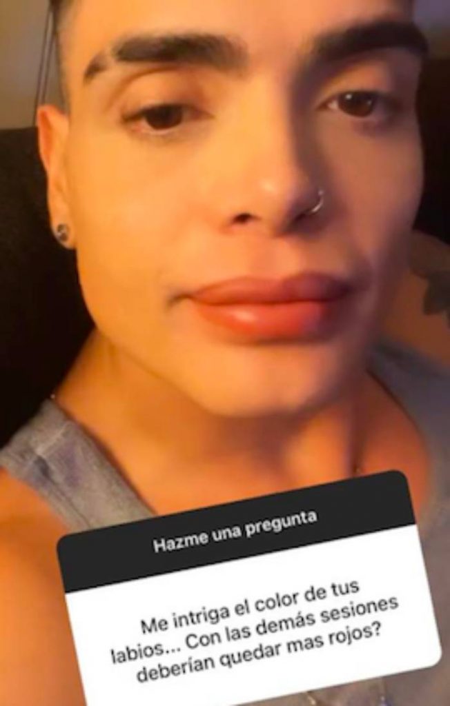 Historia De Nelson Mauri Labios