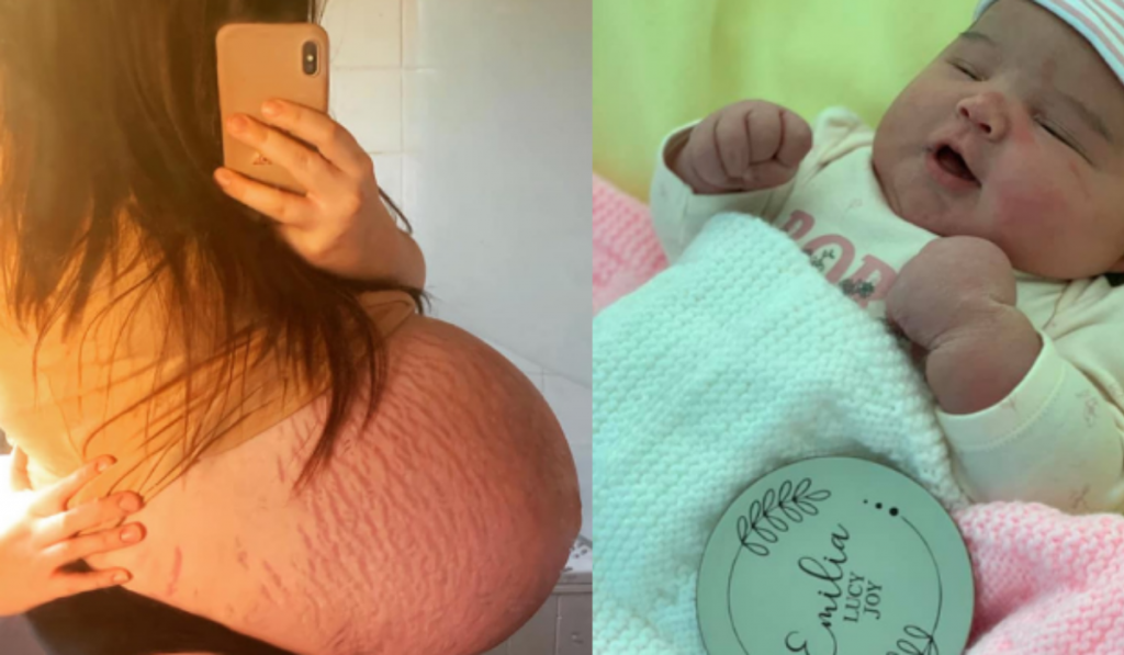 Madre da a luz a bebé de seis kilos: ¡El parto duró más de 20 horas!