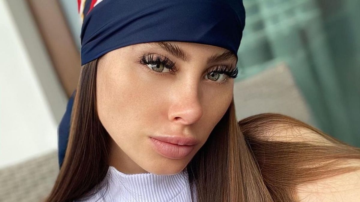 Ignacia Michelson mostró cómo era su rostro antes de las intervenciones