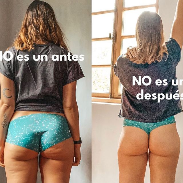 Winnie Gana Antes Y Después