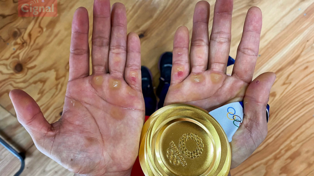 Fotos Extrañas Atletas Olímpicos