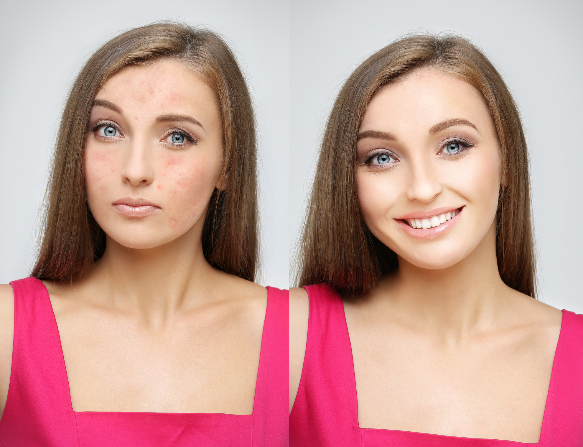 Movimiento Skin Positive: porque la piel perfecta no existe y está bien