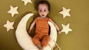 Viral: este niño tiene una enfermedad parecida a la de Benjamin Button