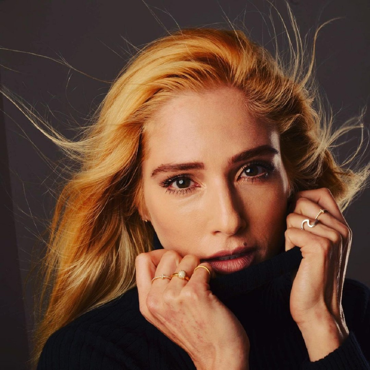 Mane Swett y su psoriasis