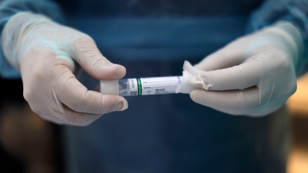 Minsal Cifra Baja 2021