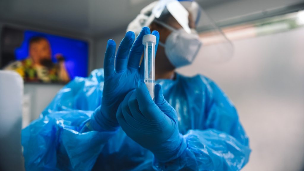 Minsal Positividad Más Baja