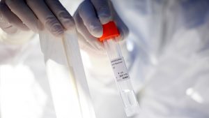 Minsal informó aumento de casos de Covid-19 en las últimas horas