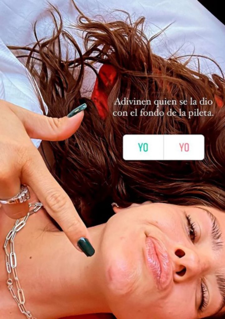 China Suárez Accidente