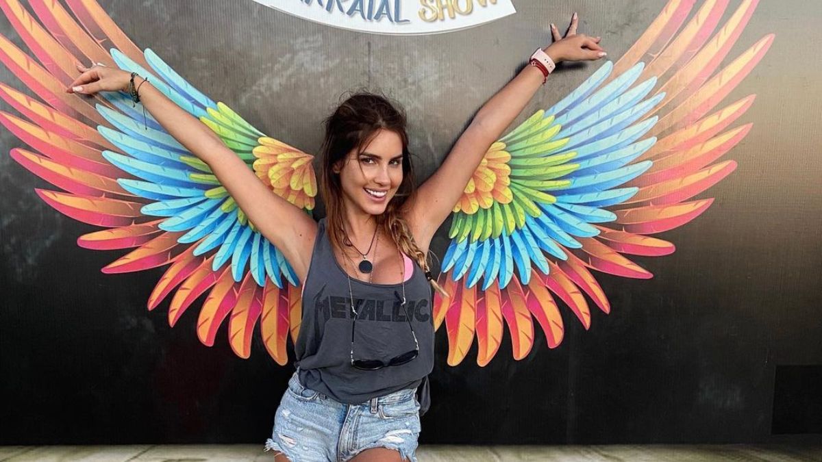 Fran Undurraga muestra en redes sociales el arreglo que se hizo en su sonrisa