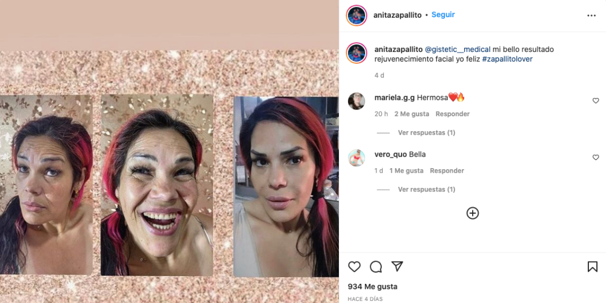 Zapallito IG