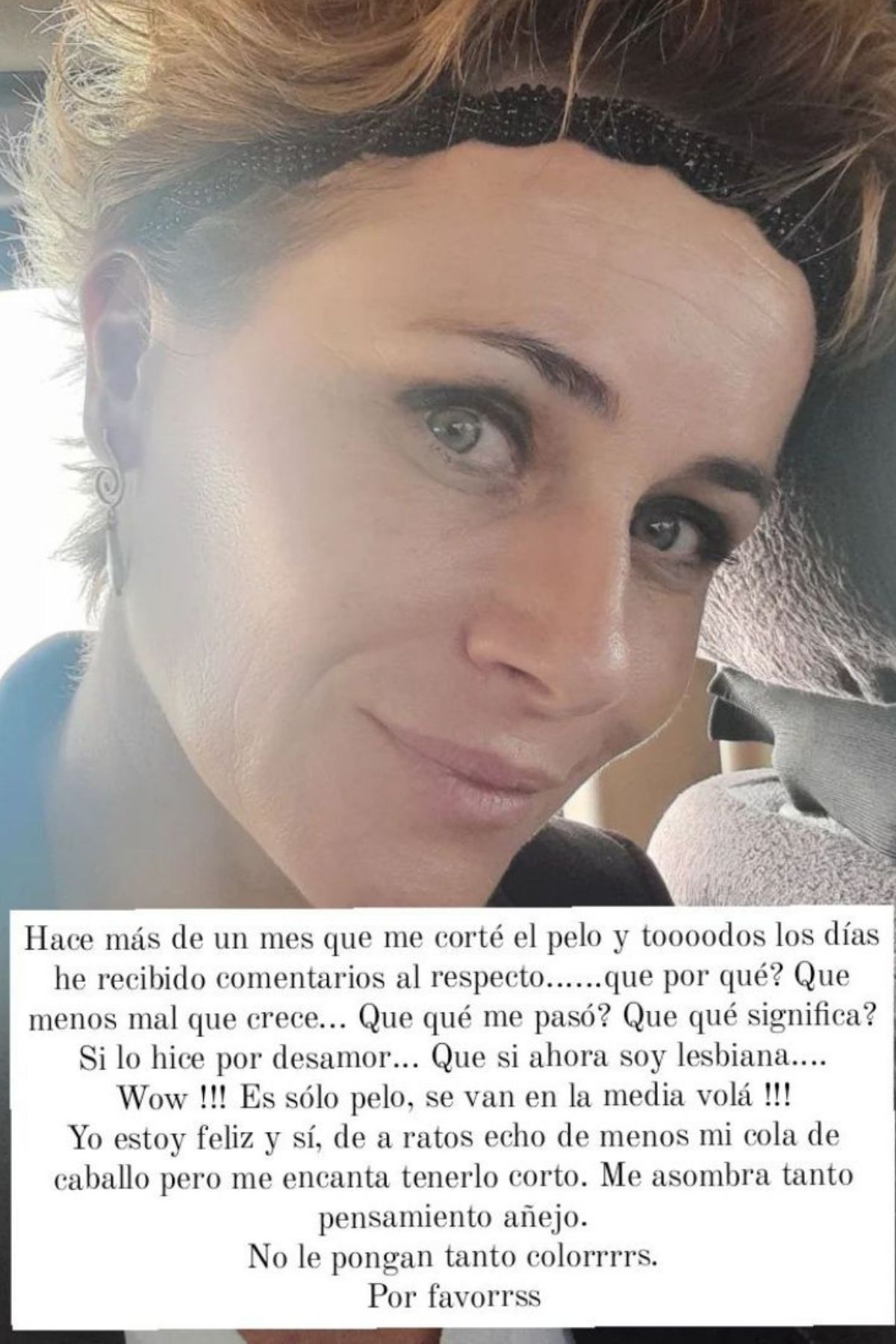 Amaya Forch Pelo Corto (1)