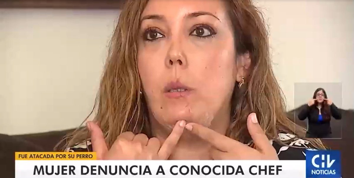 Daniela Castro Indemnizacion 