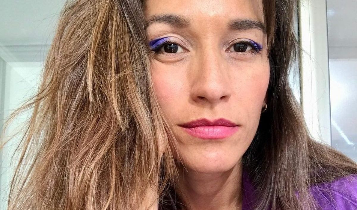 Lorena Capetillo preocupa a sus seguidores tras sufrir accidente