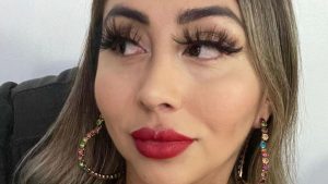 Naya Fácil se realizó nueva intervención en su rostro y compartió los resultados