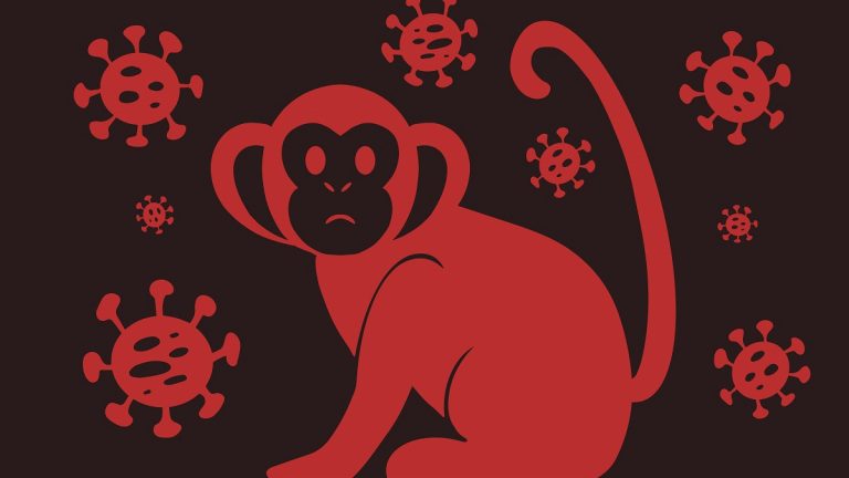Viruela del Mono en Chile