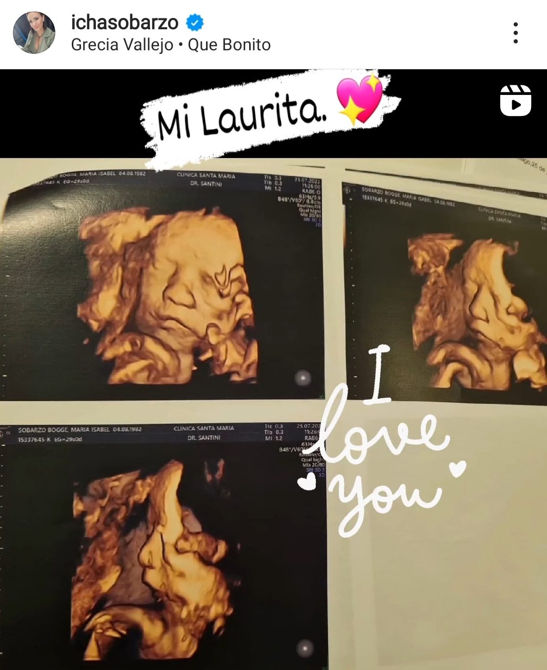 Icha Sobarzo ecografía