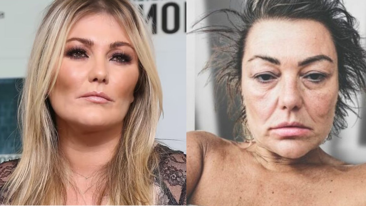 "No ha conseguido superarlo...": Revelan el estado de salud de Amaia Montero tras preocupantes fotos