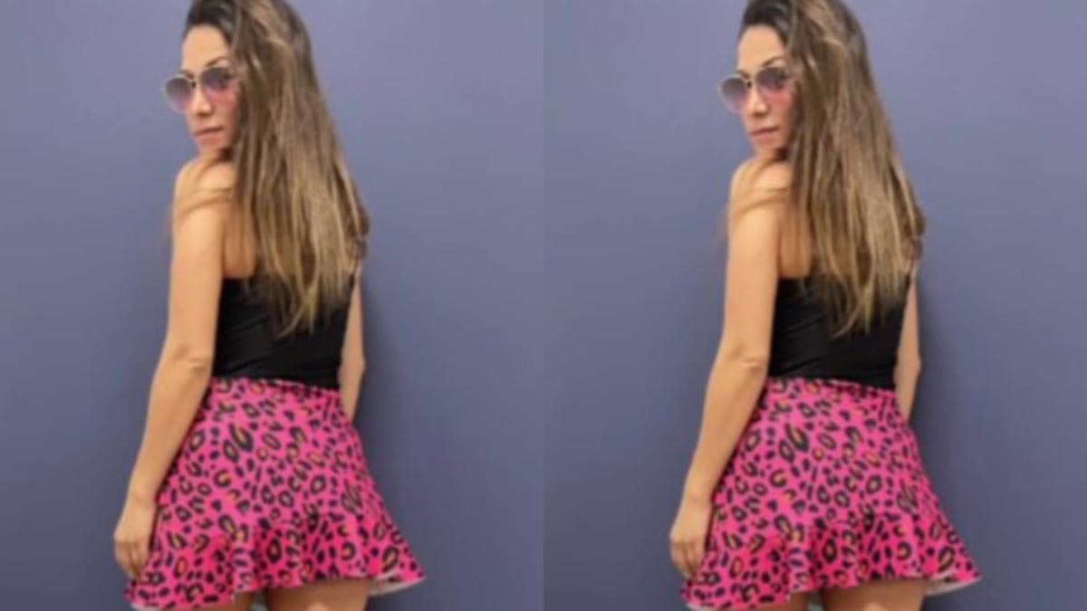 "Así va mi mordida de araña": Loreto Aravena mostró imágenes sensibles de su impactante herida