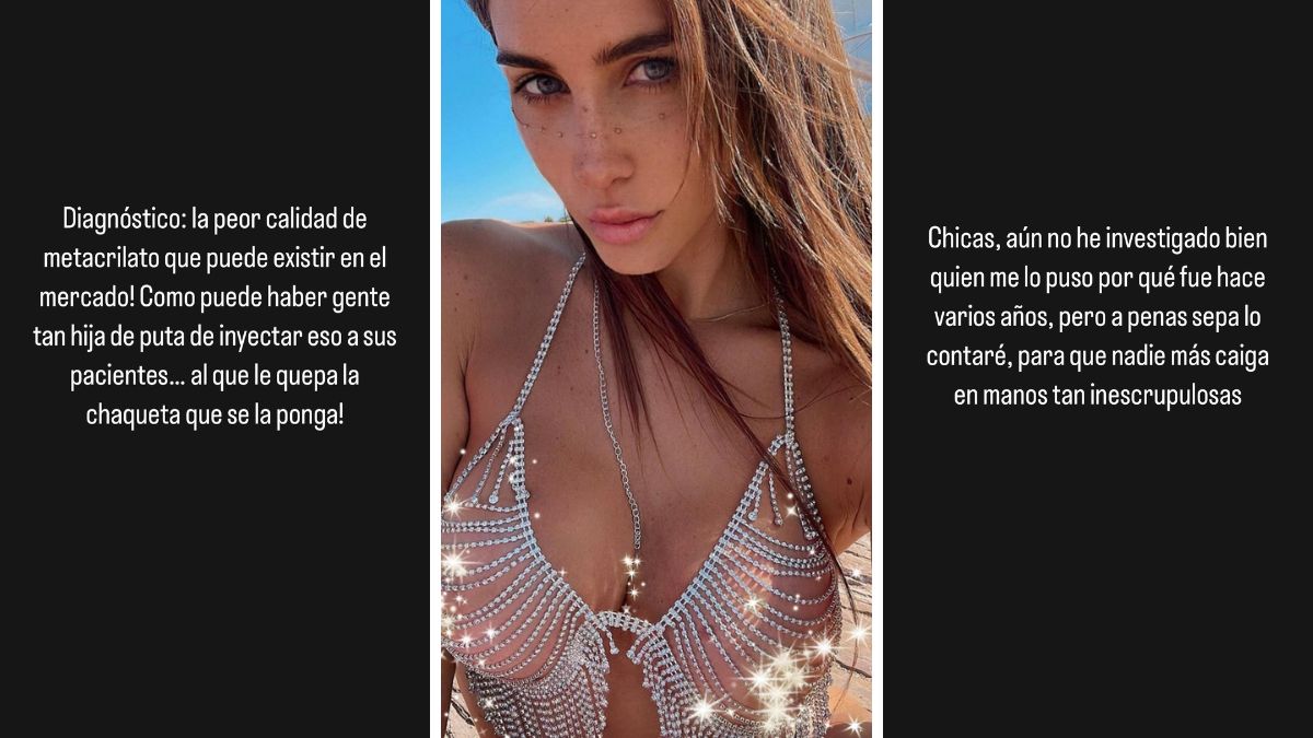 Fran Undurraga Cirugía (1)