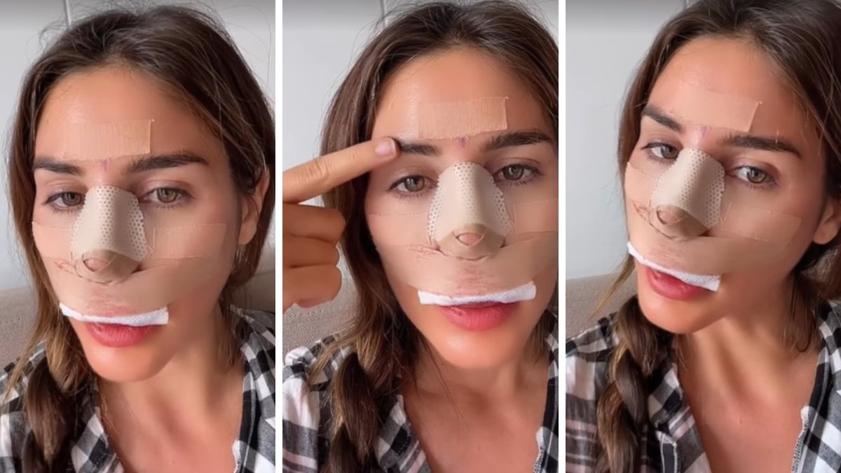 "OJO con lo que se inyectan": Fran Undurraga alertó a sus fans tras someterse a cirugía