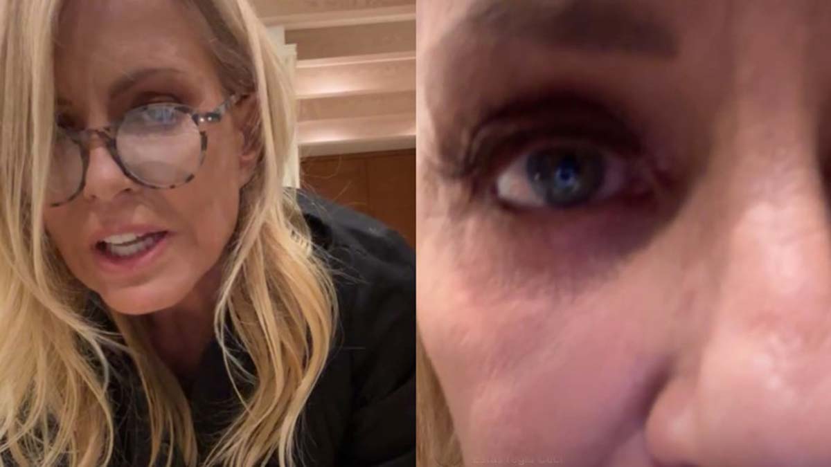 "No estoy bien salud": Cecilia Bolocco reveló en un live que sufre una compleja enfermedad