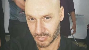 Pálido y completamente calvo: el preocupante nuevo look de Benjamín Vicuña