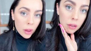 "Hoy me pasaron un láser que es para desinflamar": Daniela Aránguiz se sometió a una bichectomía y mostró los increíbles resultados