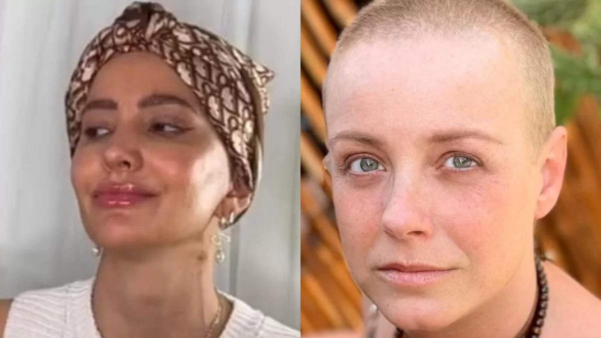 Cáncer de mama triple negativo: Esta es la enfermedad que afecta a Aylén Milla y Claudia Conserva