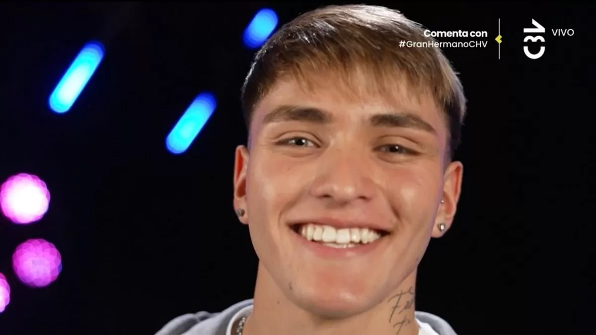 "Parece otra persona": El impactante antes y después de Hans Valdés tras someterse a procedimiento estético