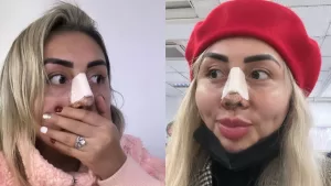 "Te quedó chueca": La nueva nariz de Naya Fácil generó ola de reacciones en redes sociales