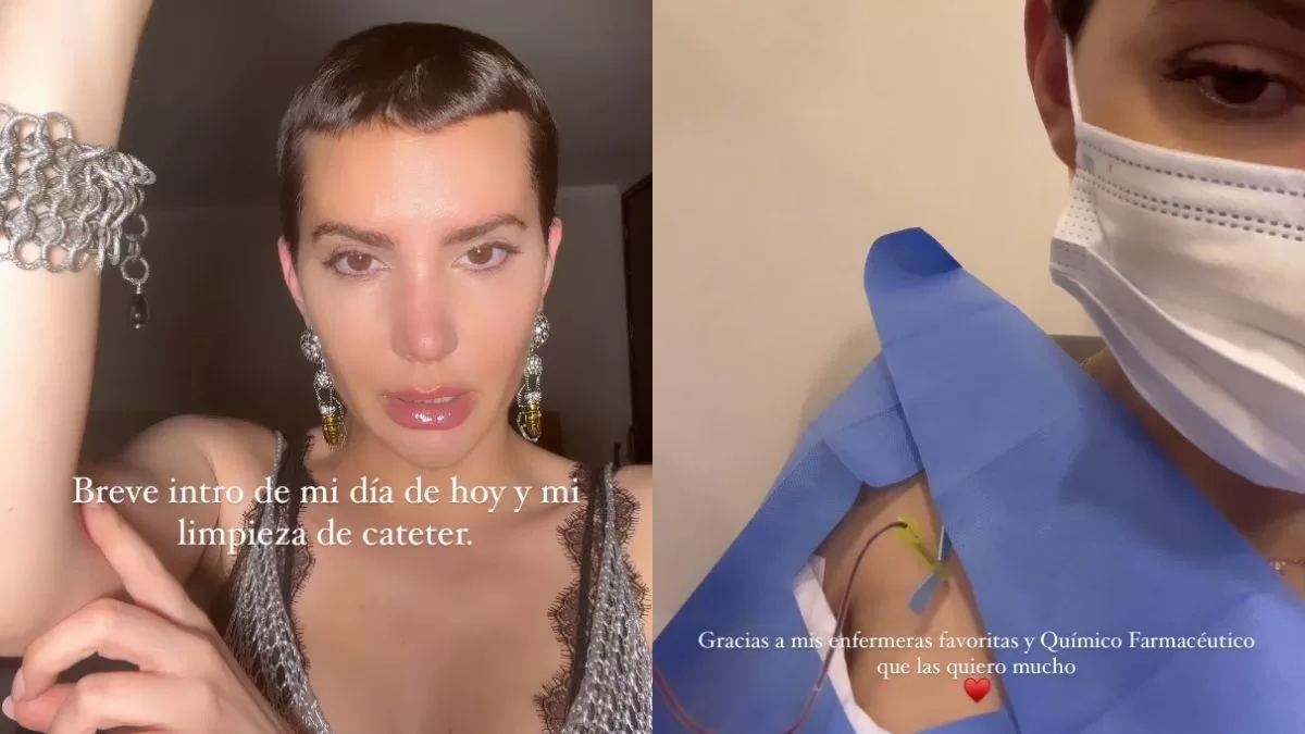 "Entré en crisis": Aylén Milla muestra parte de sus quimioterapias y revela por qué son tan importantes en su tratamiento
