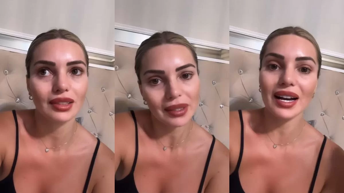 "A seguir la vida": Faloon Larraguibel impacta al mostrar cómo le quedaron los brazos tras su accidente de tránsito