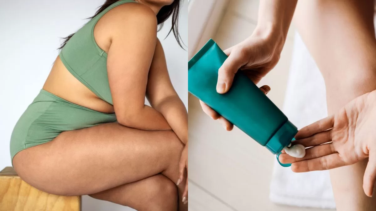 Estos son los cinco mejores tips para evitar la irritación en los muslos durante las temperaturas extremas