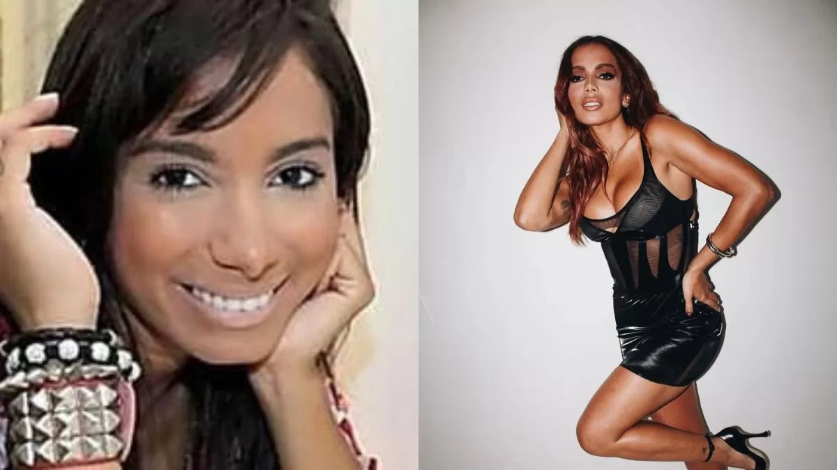 El Antes Y Despues De Anitta