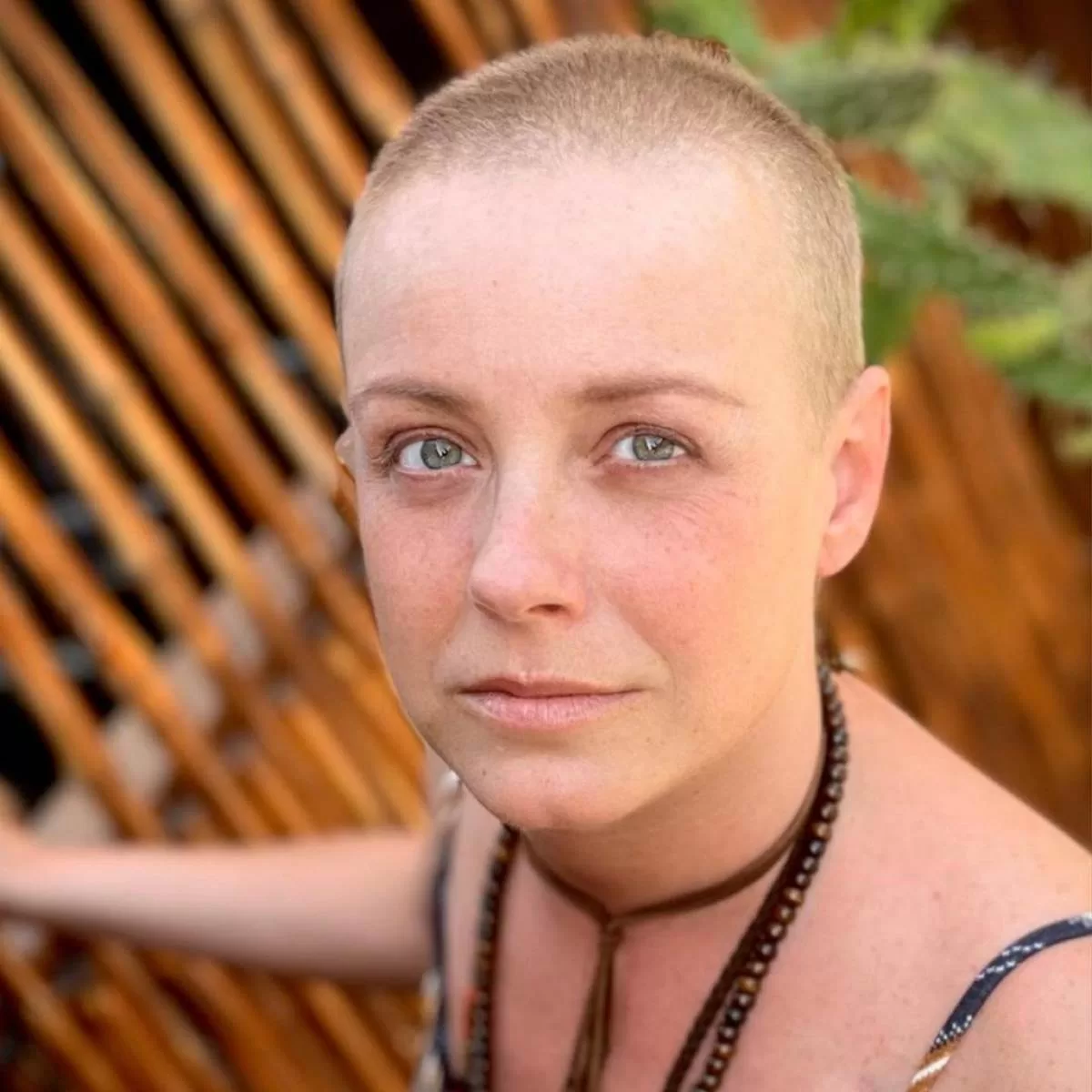 Claudia Conserva Cancer  