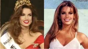 Brillo como Miss Chile y hoy revela que enfrentó un complejo cáncer: "comenzó como una escama"