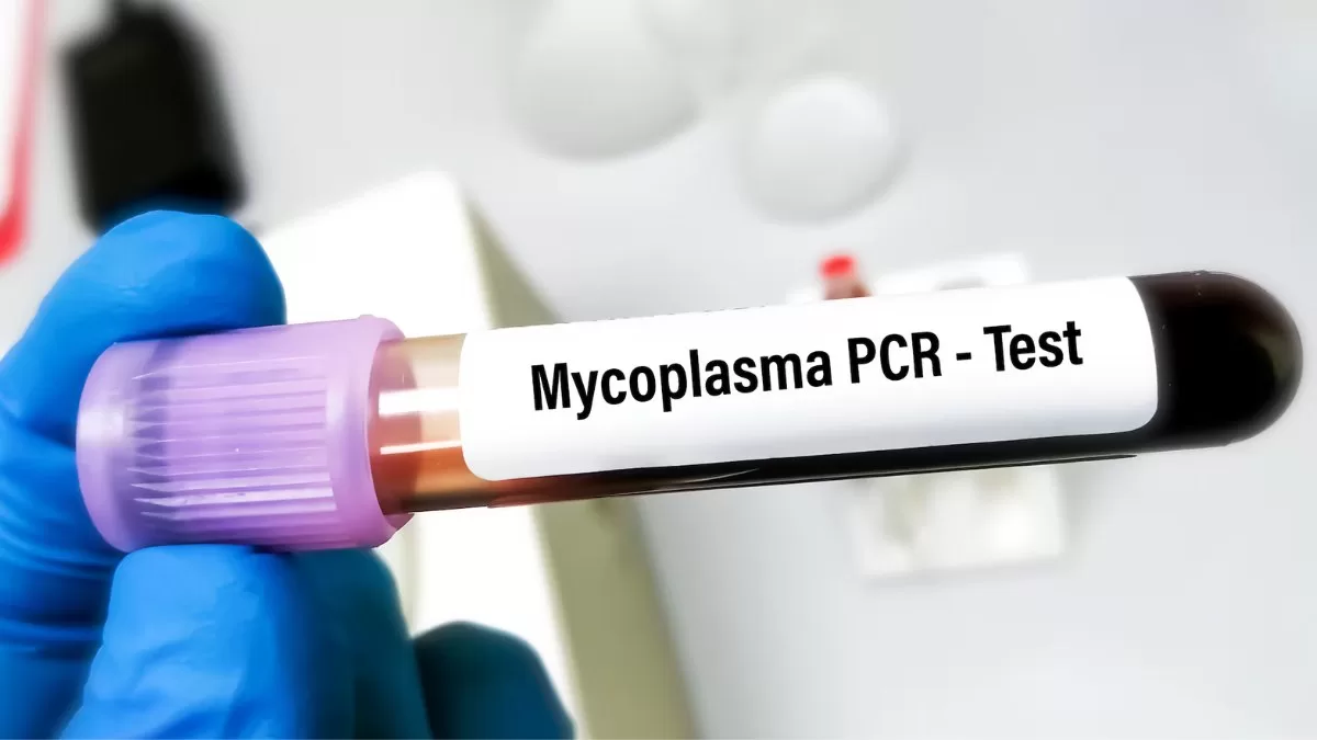 Neumonía Mycoplasma