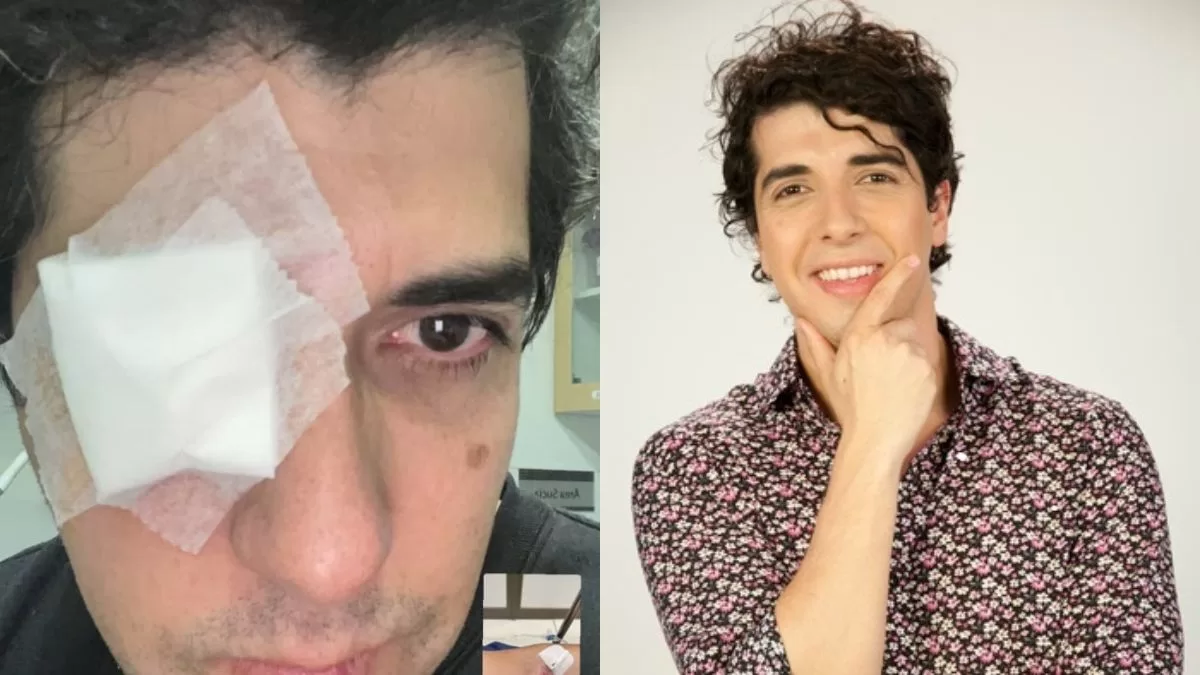Periodista chileno preocupó tras sufrir doloroso accidente: perdió la visión temporal de un ojo al practicar popular deporte