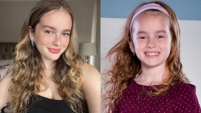 Conocida actriz chilena denunció grave accidente en un parque de atracciones: acusó de negligencia