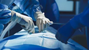 Cirugía bariátrica con Bono PAD: requisitos, precios y cómo acceder en 2025