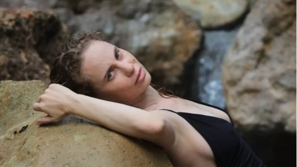 Li Fridman Alopecia (1)