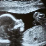 Toda una sorpresa: Reconocida ex chica reality revela el género de su segundo bebé