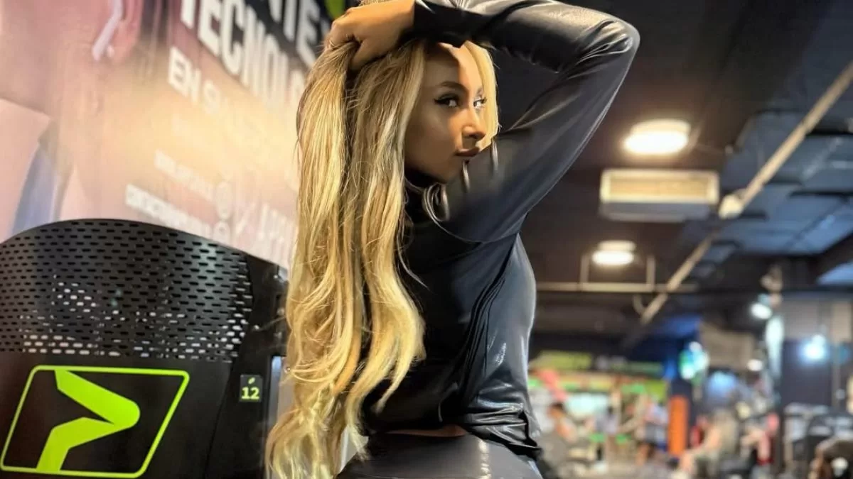 Conocida ex Miss Chile preocupó tras sufrir doloroso accidente: "Tengo dos costillas fracturadas"