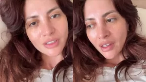 Karen Paola impacta tras dar detalles de su delicada operación luego de sufrir inesperado accidente: "Me tuvieron que poner una prótesis"