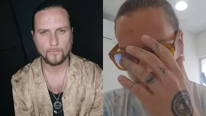 Jean Philippe Cretton sufre dolorosa fractura en TVN: "Por hacerme el chistosito"