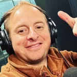 El impactante cambio de Coke Hevia a un año de su injerto capilar: "Quedaste bien. Te cambió la cara"