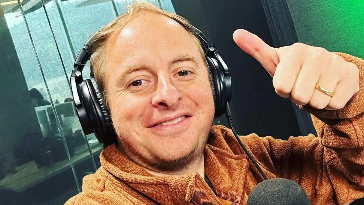 El impactante cambio de Coke Hevia a un año de su injerto capilar: "Quedaste bien. Te cambió la cara"