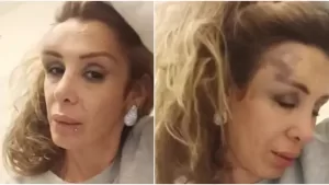 ROMINA SÁEZ AGREDIDA