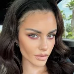 Emilia Dides se somete a drástico procedimiento estético previo a la Gala de Viña: este es el impactante resultado